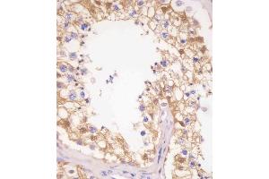 (ABIN6242519 and ABIN6577251) staining PDXK in human testis tissue sections by Immunohistochemistry (IHC-P - paraformaldehyde-fixed, paraffin-embedded sections). (PDXK anticorps  (AA 1-312))