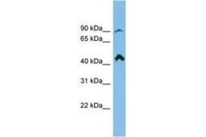 Image no. 1 for anti-NEDD4 Binding Protein 2-Like 2 (N4BP2L2) (AA 107-156) antibody (ABIN6745094) (N4BP2L2 anticorps  (AA 107-156))