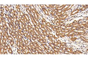 Detection of LIFR in Mouse Kidney Tissue using Polyclonal Antibody to Leukemia Inhibitory Factor Receptor (LIFR)