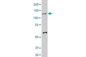 HIPK2 monoclonal antibody (M01), clone 4F4. (HIPK2 anticorps  (AA 961-1065))