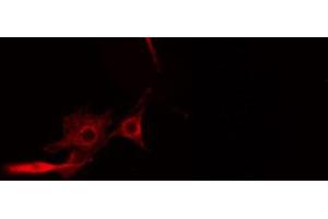 ABIN6274566 staining HeLa cells by IF/ICC.