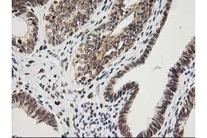 Image no. 7 for anti-Excision Repair Cross-Complementing Rodent Repair Deficiency, Complementation Group 4 (ERCC4) antibody (ABIN1498070)