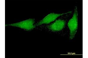 Immunofluorescence of purified MaxPab antibody to PRUNE on HeLa cell.