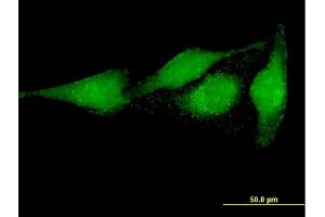 Immunofluorescence of purified MaxPab antibody to PRUNE on HeLa cell. (PRUNE anticorps  (AA 1-453))