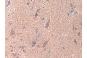 Detection of UBD in Rat Spinal cord Tissue using Polyclonal Antibody to Ubiquitin D (UBD) (UBD anticorps  (AA 1-155))