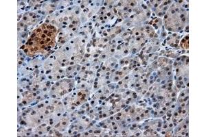 Immunohistochemical staining of paraffin-embedded Kidney tissue using anti-GBE1 mouse monoclonal antibody. (GBE1 anticorps)