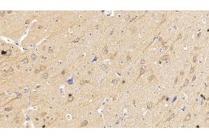 Detection of SEMA5B in Human Cerebrum Tissue using Monoclonal Antibody to Semaphorin 5B (SEMA5B)
