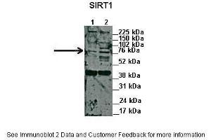 Lanes:   1. (SIRT1 anticorps  (N-Term))
