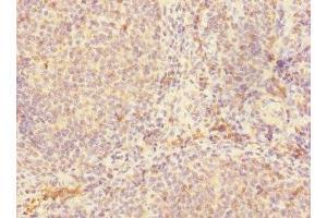 Immunohistochemistry of paraffin-embedded human tonsil tissue using ABIN7147132 at dilution of 1:100 (Integrin beta 2 anticorps  (AA 24-220))