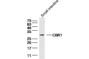 Mouse small intestine lysate (40ug) probed with CBR1 Polyclonal Antibody, unconjugated  at 1:300 overnight at 4°C followed by a conjugated secondary antibody for 60 minutes at 37°C. (CBR1 anticorps  (AA 201-277))