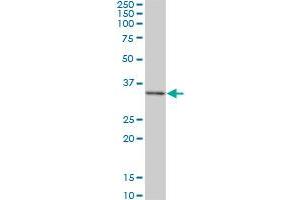 DKK1 monoclonal antibody (M02), clone 1F5. (DKK1 anticorps  (AA 81-180))