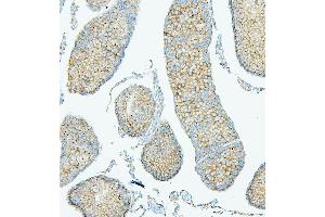 IHC analysis of PDCD6IP using anti-PDCD6IP antibody (ABIN7600490). (ALIX anticorps  (AA 2-330))