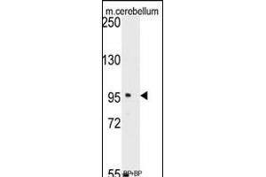 Western blot analysis of anti-SEA Antibody (C-term) (ABIN389214 and ABIN2839370) pre-incubated with(right lane) and without(left lane) blocking peptide in mouse cerebellum tissue lysate. (SEMA6A anticorps  (C-Term))