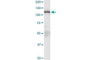 Immunoprecipitation of PKN1 transfected lysate using anti-PKN1 MaxPab rabbit polyclonal antibody and Protein A Magnetic Bead , and immunoblotted with PKN1 purified MaxPab mouse polyclonal antibody (B01P) .