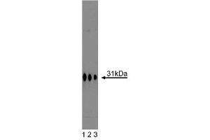 Western blot analysis of Syntaxin 6 on a A431 cell lysate (Human epithelial carcinoma, ATCC CRL-1555). (Syntaxin 6 anticorps  (AA 6-136))
