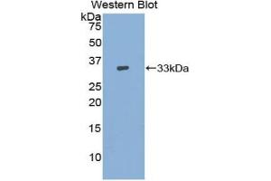Western blot analysis of the recombinant protein. (ADCY9 anticorps  (AA 1029-1282))