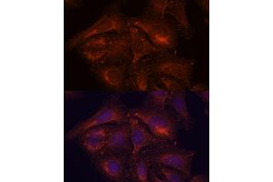 Immunofluorescence analysis of U-2 OS cells using ENAH antibody (ABIN7266936) at dilution of 1:100.