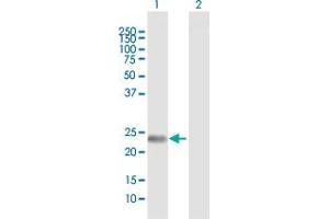Western Blot analysis of FNDC4 expression in transfected 293T cell line by FNDC4 MaxPab polyclonal antibody.