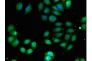 Immunofluorescent analysis of A549 cells using ABIN7145071 at dilution of 1:100 and Alexa Fluor 488-congugated AffiniPure Goat Anti-Rabbit IgG(H+L) (COQ8B anticorps  (AA 10-137))