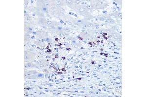 Immunohistochemistry of paraffin-embedded human liver using TLR9 Rabbit pAb (ABIN7270849) at dilution of 1:100 (40x lens).