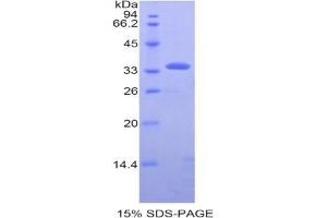 SDS-PAGE analysis of Human PDHb Protein.