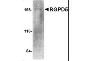 Western blot analysis of RGPD5 in human thymus tissue lysate with this product at 1 μg/ml. (RGPD5 / RGPD6 (N-Term) anticorps)