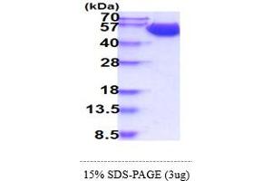 SDS-PAGE (SDS) image for Solute Carrier Family 3 (Activators of Dibasic and Neutral Amino Acid Transport), Member 2 (SLC3A2) (AA 206-630) protein (His tag) (ABIN5855007)