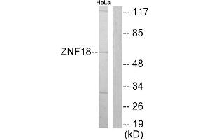 Western blot analysis of extracts from HeLa cells, using ZNF18 antibody. (ZNF18 anticorps  (Internal Region))