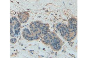 Used in DAB staining on fromalin fixed paraffin- embedded Kidney tissue