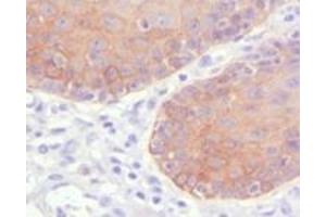 Immunohistochemistry (IHC) image for anti-Keratin 5 (KRT5) (truncated) antibody (ABIN2464042)