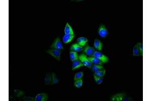 Immunofluorescence staining of Hela cells with ABIN7171484 at 1:133, counter-stained with DAPI. (TLN1 anticorps  (AA 92-399))
