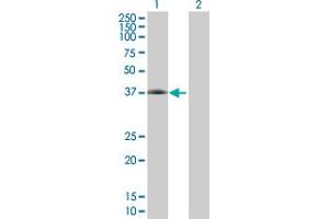 Western Blot analysis of CFHR1 expression in transfected 293T cell line by CFHR1 MaxPab polyclonal antibody. (CFHR1 anticorps  (AA 1-330))