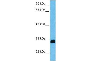 Host:  Mouse  Target Name:  PDX1  Sample Tissue:  Mouse Testis  Antibody Dilution:  1ug/ml (PDX1 anticorps  (N-Term))