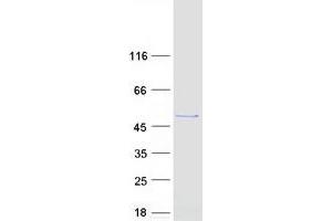 Validation with Western Blot