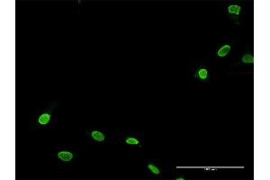 Immunofluorescence of purified MaxPab antibody to TNNI3K on HeLa cell.