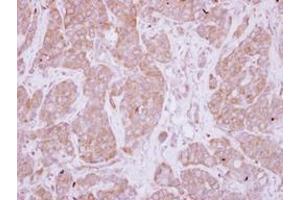 Image no. 1 for anti-Protein Phosphatase, EF-Hand Calcium Binding Domain 1 (PPEF1) (AA 361-650) antibody (ABIN1500360)