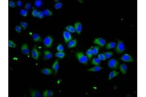 Immunofluorescence staining of Hela cells with ABIN7169635 at 1:133, counter-stained with DAPI. (SCUBE1 anticorps  (AA 453-566))