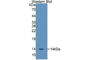 Western blot analysis of the recombinant protein. (SRP9 anticorps  (AA 2-86))