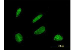 Immunofluorescence of monoclonal antibody to DBF4 on HeLa cell. (DBF4 anticorps  (AA 2-98))