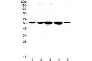 Western blot testing of human 1) placenta, 2) HeLa, 3) 22RV1, 4) SKOV and 5) A549 lysate with ETV6 antibody at 0. (ETV6 anticorps)