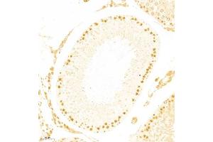 Immunohistochemistry of paraffin embedded rat testis using APOBEC4 (ABIN7073086) at dilution of 1:800 (200x lens) (APOBEC4 anticorps)