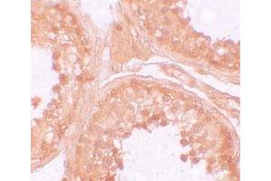 Immunohistochemical staining of human testis cells with NLRP9 polyclonal antibody  at 10 ug/mL.