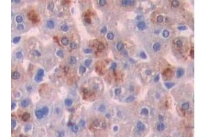 Detection of SHH in Mouse Liver Tissue using Polyclonal Antibody to Hedgehog Homolog, Sonic (SHH)