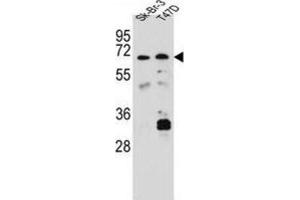 Western Blotting (WB) image for anti-Carboxylesterase 4A (CES4A) antibody (ABIN2997050)