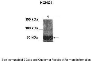 Lanes:   100 ug CHO cell lysate  Primary Antibody Dilution:   1:1000  Secondary Antibody:   Goat anti-rabbit HRP  Secondary Antibody Dilution:   1:25000  Gene Name:   KCNQ4  Submitted by:   Anonymous (KCNQ4 anticorps  (Middle Region))