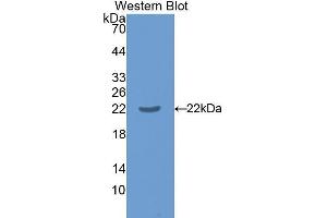 Western Blotting (WB) image for anti-Interleukin 17 Receptor B (IL17RB) (AA 166-354) antibody (ABIN1859362) (IL17 Receptor B anticorps  (AA 166-354))
