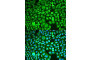 Immunofluorescence analysis of A549 cell using ETS1 antibody. (ETS1 anticorps)