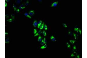 Immunofluorescence staining of Hela cells with ABIN7175204 at 1:66, counter-stained with DAPI.