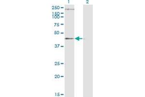 Western Blot analysis of STEAP1 expression in transfected 293T cell line by STEAP1 monoclonal antibody (M01A), clone 4F6-1F3. (STEAP1 anticorps  (AA 1-339))