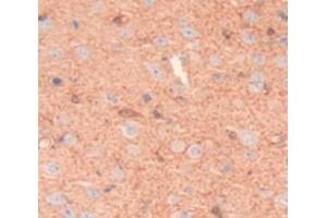 anti-Lymphocyte Function Associated Antigen 2 (AA 27-203) antibody